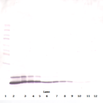 To detect hRANTES by Western Blot analysis this antibody can be used at a concentration of 0.1-0.2 ug/ml. Used in conjunction with compatible secondary reagents the detection limit for recombinant hRANTES is 1.5-3.0 ng/lane, under either reducing or non-reducing conditions.