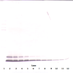 To detect hRANTES by Western Blot analysis this antibody can be used at a concentration of 0.1-0.2 ug/ml. Used in conjunction with compatible secondary reagents the detection limit for recombinant hRANTES is 1.5-3.0 ng/lane, under either reducing or non-reducing conditions.