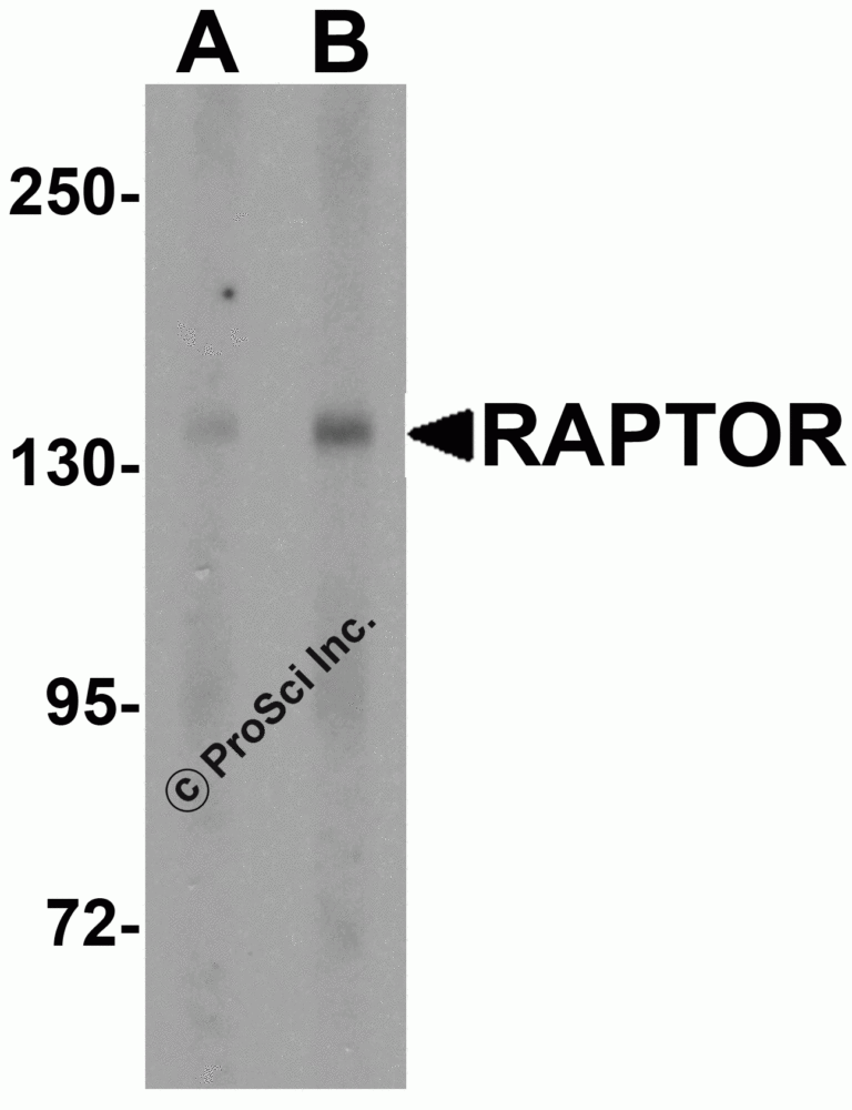 Raptor Antibody