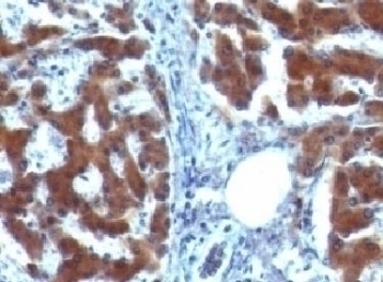 RBP Antibody [RLBD1]