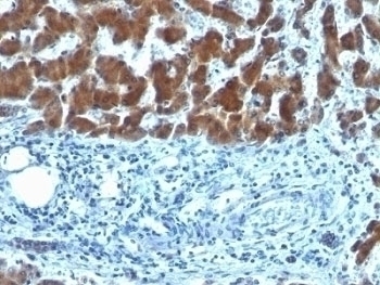 RBP Antibody [SPM442]