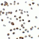 Immunocytochemistry of REEP3 in A431 cells with REEP3 antibody at 5 μg/mL.