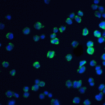 Immunofluorescence of REEP3 in A431 cells with REEP3 antibody at 20 μg/mL.<br><br>Green: REEP3 Antibody (5573) <br> Blue: DAPI staining