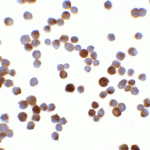 Immunocytochemistry of RFX1 in Hela cells with RFX1 antibody at 5 μg/mL.