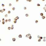 Immunocytochemistry of RICK in K562 cells with RICK antibody at 2.5 μg/mL.