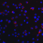 Immunofluorescence of RIG-1 in MCF7 cells with RIG-1 Antibody at 20 μg/mL.