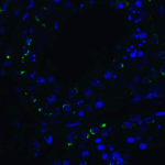 Immunofluorescence of RIG-1 in human testis tissue with RIG-1 Antibody at 20 μg/mL.