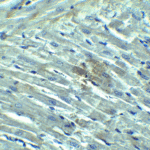 Immunohistochemistry of RIG-1 in rat heart tissue with RIG-1 Antibody at 10 μg/mL.