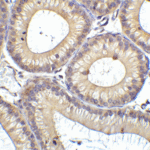 Immunohistochemistry of RIG-1 in mouse testis tissue with RIG-1 Antibody at 1 μg/mL.