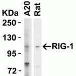 Western blot analysis of RIG-1 in Lane 1) A20 cell lysate and Lane 2) Rat heart tissue lysate with RIG-1 antibody at 2 μg/mL.