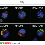 <strong>Figure 11 Regulated Expression Validation of RIP3 in Macrophages (Li et al., 2016) </strong><br>Confocal microscopy shows colocalization of RIPK1 (green) and RIPK3 (red) in PM and RIPK3 was detected by anti-RIPK3 antibodies (2283). PF or BCM suppressed LPS-induced upregulation of RIP3.