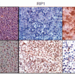 <strong>Figure 8 Immunohistochemistry Validation of RIP3 in Fadd KO mice (Zhang et al., 2011) </strong><br>RIP3 expression detected by anti-RIP3 antibodies (2283) was decreased in Fadd KO mice as compared to WT mice.