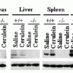 <strong>Figure 7 KO Validation of RIP3 in RIP3 KO Mice (He et al., 2009) </strong><br>Western blot analysis of RIP3 with anti-RIP3 antibodies shows disrupted RIP3 expression in pancreas, liver spleen thymus and lung of RIP3 KO mice. Cerulein treatment upregulated RIP3 expression in the pancreas of WT mice.