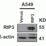 <strong>Figure 12 Overexpression Validation of RIP3 in Cancer Cell Lines (Yang et al., 2017) </strong><br>The cancer cell lines were stably expressing flag-tagged RIP3 and RIP expression was detected by anti-RIP3 antibodies (2283) in RIP3-overexpressed cells.