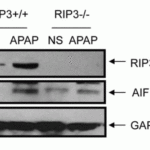 <strong>Figure 13 Induced Expression of RIP3 by Acetaminophen in WT and RIP3 KO Mice (Ramachandran et al., 2013) </strong><br>Wild-type and RIP3 KO mice were treated with300 mg/kg acetaminophen or saline. RIP3 expression detected by anti-RIP3 antibodies (2283) were up-regulated after acetaminophen treatment in the liver, while this effect was not observed in RIP3 KO mice.