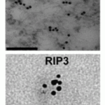 <strong>Figure 15 Immunogold EM Validation in MEF Cells (Li et al., 2012) </strong><br>Clustering of RIP3 in necrotic MEFs shown by immunogold EM with anti-RIP3 antibodies (2283). Scale bars, 100 nm (RIP3).