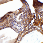<strong>Figure 7 Immunohistochemistry Validation of RSPO1 in Human Spleen Tissue </strong><br> Immunohistochemical analysis of paraffin-embedded human spleen tissue using anti-RSPO1 antibody (5171) at 5 μg/ml. Tissue was fixed with formaldehyde and blocked with 10% serum for 1 h at RT; antigen retrieval was by heat mediation with a citrate buffer (pH6). Samples were incubated with primary antibody overnight at 4°C. A goat anti-rabbit IgG H&L (HRP) at 1/250 was used as secondary. Counter stained with Hematoxylin.