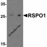 <strong>Figure 4 Western Blot Validation in Human Heart</strong><br>Loading: 15 μg of lysates per lane.Antibodies: RSPO1, 5171 (A: 1 μg/mL, B: 2 μg/mL), 1h incubation at RT in 5% NFDM/TBST.Secondary: Goat anti-rabbit IgG HRP conjugate at 1:10000 dilution.