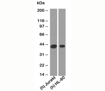 RUNX3 Antibody [RNX864]