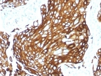 Recombinant Acidic Cytokeratin Antibody [KRTL/1577R]