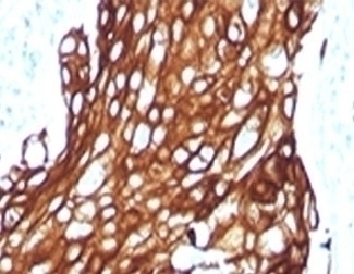 Recombinant Acidic Cytokeratin Antibody [RMAK1-1]