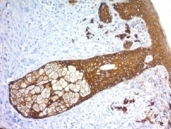 Recombinant Basic Cytokeratin Antibody [KRTH/1576R]