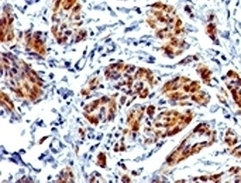 Recombinant CAD Antibody [RMCDN1-1]
