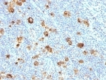 Recombinant CD15 Antibody [FUT4/1478R]