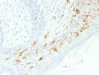 Recombinant CD1a Antibody [C1A/1506R]