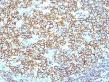 Recombinant CD20 Antibody [IGEL/1497R]