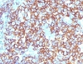 Recombinant CD20 Antibody [RMC20-1]