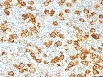 Recombinant CD30 Antibody [Ki-1/1505R]