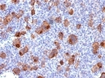 Recombinant CD30 Antibody [Ki-1/1747R]