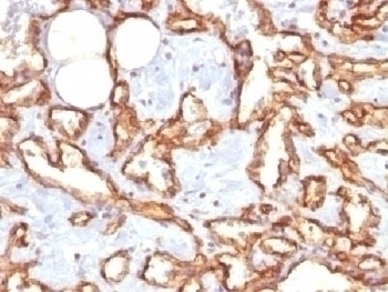 Recombinant CD31 Antibody [C31/1395R]