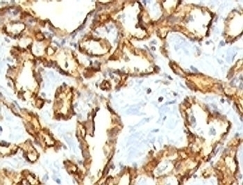 Recombinant CD31 Antibody [RMCD31-1]