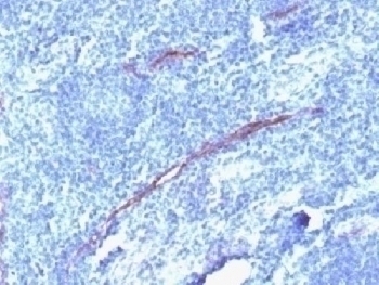 Recombinant CD34 Antibody [HPCA1/1806R]