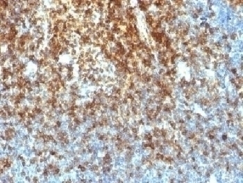 Recombinant CD43 Antibody [SPN/1766R]