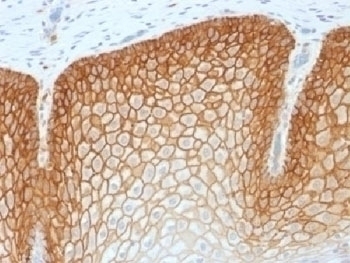 Recombinant CD44v4 Antibody [CD44v4/1700R]