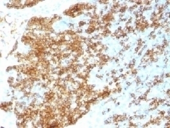 Recombinant CD45RB Antibody [PTPRC/1783R]
