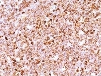 Recombinant CD79a Antibody [IGA/1688R]