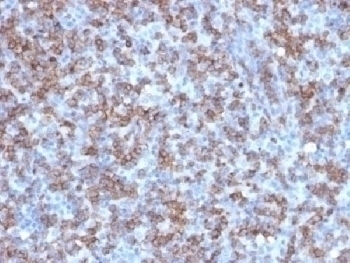 Recombinant CD8 Antibody [C8/1779R]