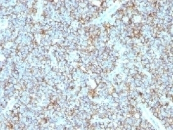 Recombinant CD99 Antibody [MIC2/1495R]