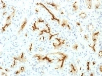 Recombinant CFTR Antibody [CFTR/1775R]
