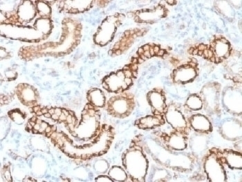 Recombinant Cadherin 16 Antibody [CDH16/1532R]