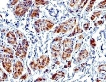 Recombinant Caldesmon Antibody [CALD1/1424R]
