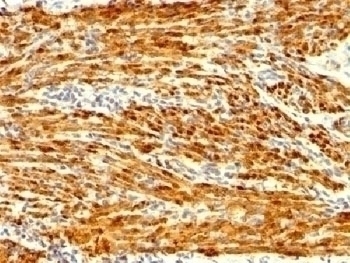 Recombinant Calponin Antibody [CNN1/1408R]
