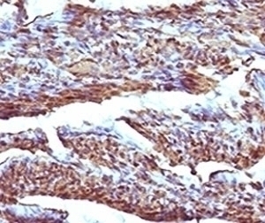 Recombinant Calponin Antibody [RMCN1-1]