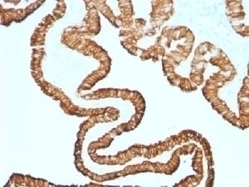 Recombinant Cytokeratin 7 Antibody [KRT7/1499R]