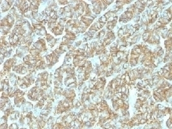 Recombinant EpCAM Antibody [EGP40/1555R]