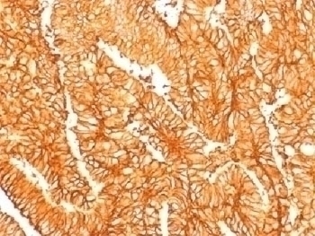 Recombinant EpCAM Antibody [EGP40/1556R]